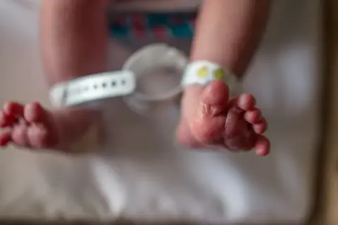 Stopy noworodka z opaską identyfikacyjną na nadgarstku.